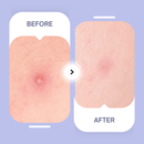 Spotted Nighttime - Original Hydrocolloid Patches-5