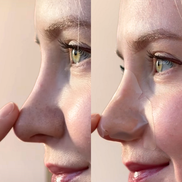 Spotted Pores - Hydrocolloid Nose Patches